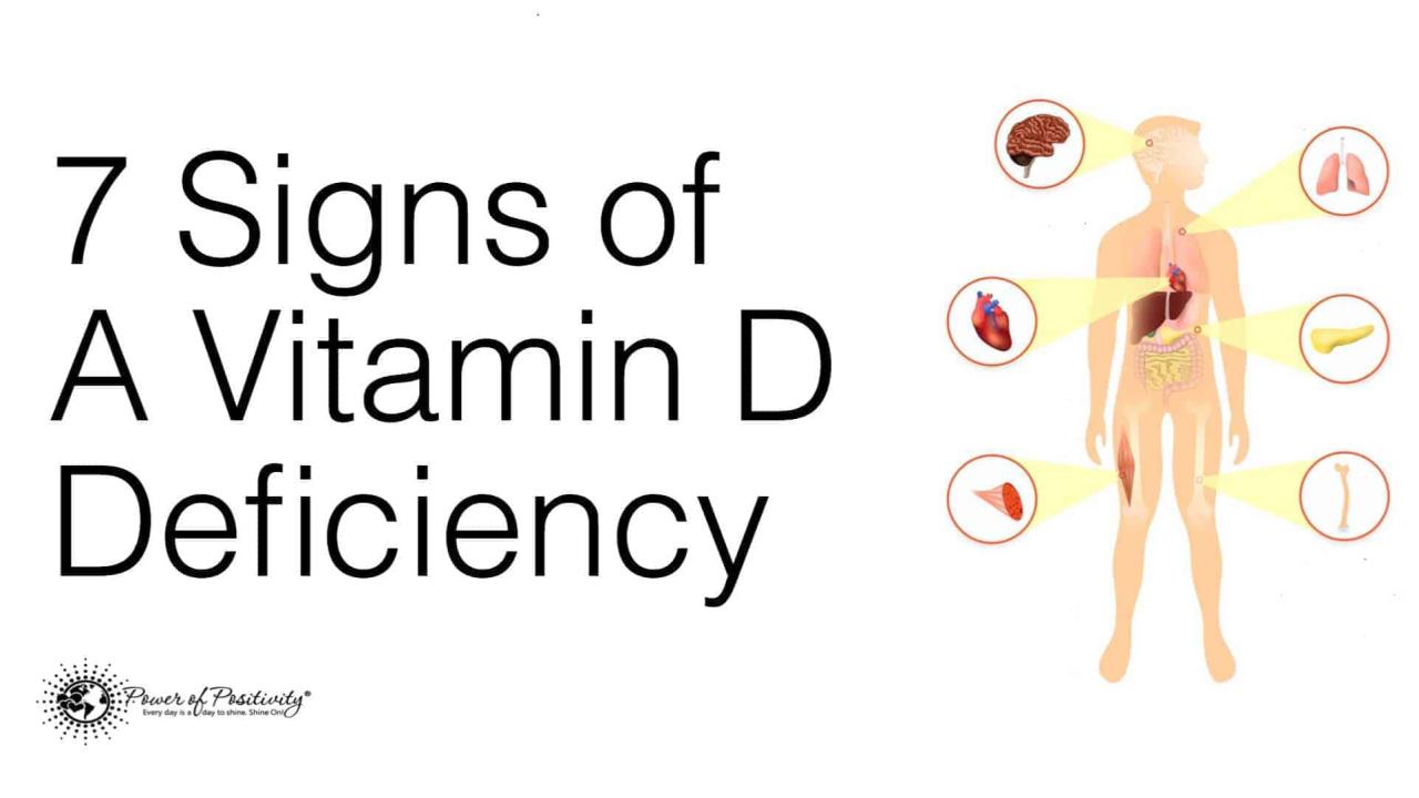 Signs of vitamin d deficiency – Artofit Signs of vitamin d deficiency – Artofit