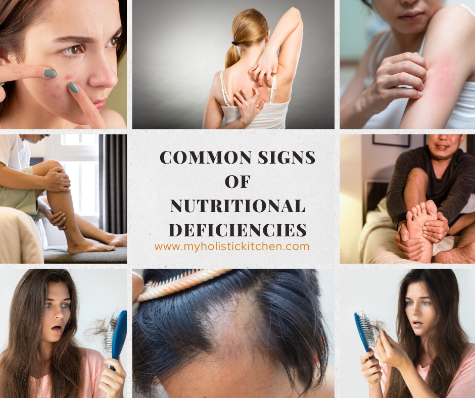 Common signs of Nutritional deficiencies – My Holistic Kitchen Signs Of Nutritional Deficiencies To Watch For