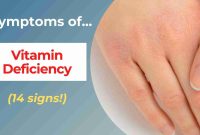 What Are The Signs Of Vitamin Deficiency Explained What Are The Signs Of Vitamin Deficiency Explained